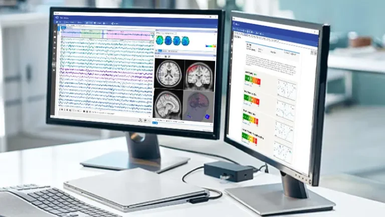 BrainView Neural Scan